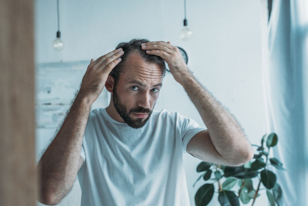 Man looking into mirror and checking for hair loss on scalp